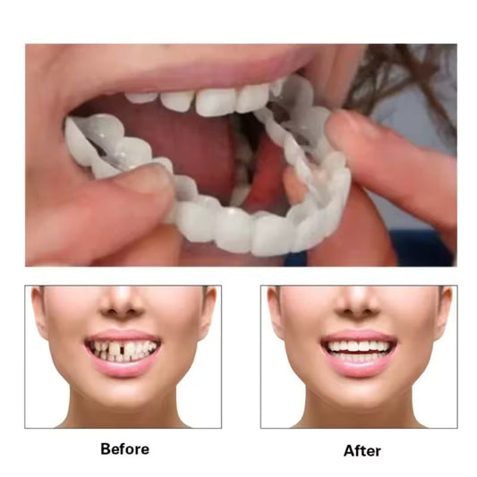 Teeth Whitening Teeth Snap on Silicone Smile Veneers Teeth Dental